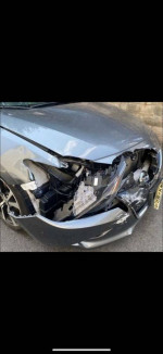 AUTO BODY REPAIR/DENT REMOVAL