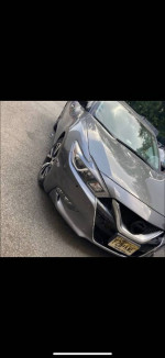 AUTO BODY REPAIR/DENT REMOVAL