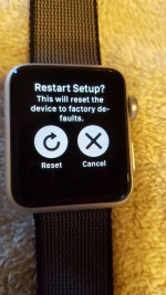 APPLE and FITBIT WATCHES - EACH