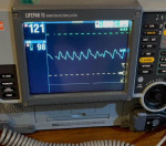 Lifepak 15 Defibrillator